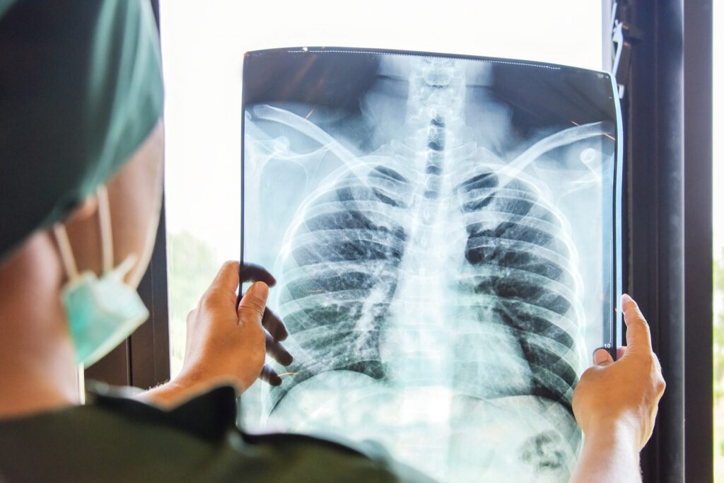 Campanie de screening pentru depistarea tuberculozei, în Gilău, Iara, Florești și Aghireșu